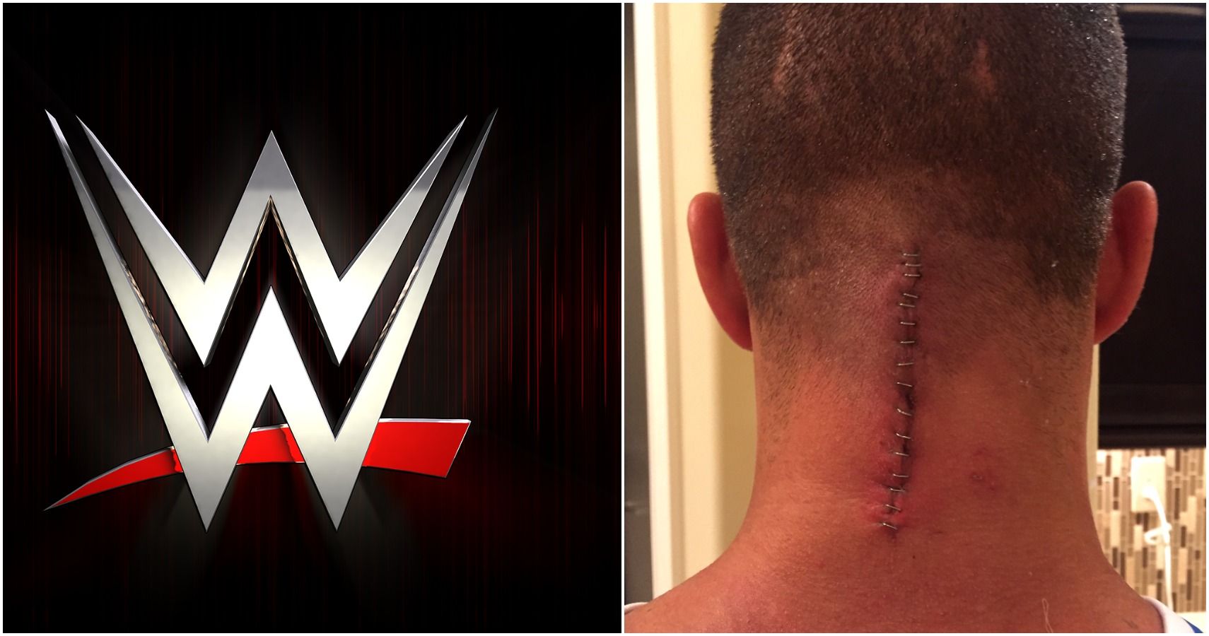 WWE Superstar Who Suffered Career Ending Injury Seen Training